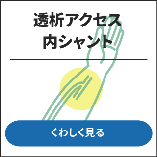 透析アクセス、内シャント