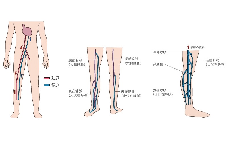 下肢静脈瘤って何 メカニズム編 大宮セントラルクリニック