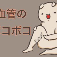 下肢静脈瘤で足の血管がボコボコするよ